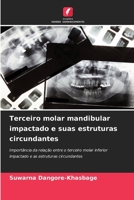 Terceiro molar mandibular impactado e suas estruturas circundantes (Portuguese Edition) 6209509975 Book Cover