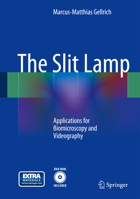 The Slit Lamp: Applications for Biomicroscopy and Videography 3642397921 Book Cover