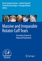 Massive and Irreparable Rotator Cuff Tears: From Basic Science to Advanced Treatments 3662611643 Book Cover