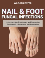 NAIL & FOOT FUNGAL INFECTIONS: Understanding The Causes And Supportive Strategies For Treatment And Prevention B0FVVZB7SF Book Cover