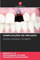 Complicações No Implante (Portuguese Edition) 6207122062 Book Cover