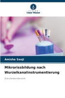 Mikrorissbildung nach Wurzelkanalinstrumentierung 6202452307 Book Cover