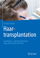 Haartransplantation: Grundlagen – Operationstechniken – Tipps und Tricks für die Praxis null Book Cover