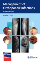 Management of Orthopaedic Infections: A Practical Guide 1684201330 Book Cover