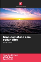 Granulomatose com poliangiite (Portuguese Edition) 6209325491 Book Cover