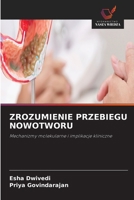 Zrozumienie Przebiegu Nowotworu 6630214412 Book Cover