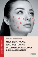 Oily Skin, Acne, and Post-Acne in Cosmetic Dermatology & Skincare Practice 1970196254 Book Cover