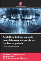 Sculpting Smiles: Um guia completo para a cirurgia de implantes guiada 6207308913 Book Cover