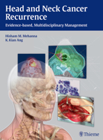 Head and Neck Cancer Recurrence: Evidence-based, Multidisciplinary Management 3131473916 Book Cover