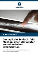 Das apikale Schlachtfeld: Mechanismen der akuten endodontischen Exazerbation (German Edition) 6209486991 Book Cover