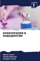 КРИОТЕРАПИЯ В ЭНДОДОНТИИ 6206244490 Book Cover