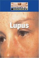 Lupus (Diseases and Disorders) 159018999X Book Cover