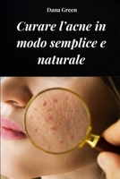 CURARE L’ACNE IN MODO SEMPLICE E NATURALE: Come curare l’acne depurando il nostro organismo e con rimedi esclusivamente naturali (Italian Edition) B0FCY4WVKF Book Cover