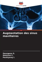 Augmentation des sinus maxillaires (French Edition) 6206653730 Book Cover