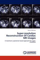 Super-resolution Reconstruction Of Cardiac MR Images: A maximum a-posteriori based approach for super-resolution 3846538159 Book Cover