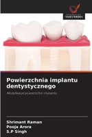 Powierzchnia implantu dentystycznego (Polish Edition) 6630306759 Book Cover