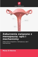 Zaburzenia zwiazane z menopauza: opis i mechanizmy: Zaburzenia zwiazane z menopauza: opis i mechanizmy (Polish Edition) 6208802210 Book Cover