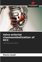 Intra-arterial chemoembolization of HCC 620632513X Book Cover