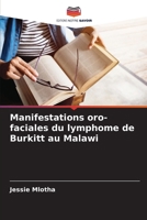 Manifestations oro-faciales du lymphome de Burkitt au Malawi (French Edition) 6208653576 Book Cover