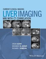 Liver Imaging: MRI with CT Correlation 0470906251 Book Cover