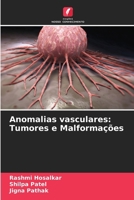 Anomalias vasculares: Tumores e Malformações (Portuguese Edition) 6206934675 Book Cover