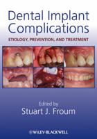 Dental Implant Complications 0813808413 Book Cover