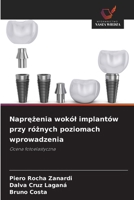 Naprezenia wokól implantów przy róznych poziomach wprowadzenia: Ocena fotoelastyczna (Polish Edition) 6208808405 Book Cover