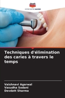 Techniques d'élimination des caries à travers le temps 6207529251 Book Cover