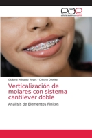 Verticalización de molares con sistema cantilever doble: Análisis de Elementos Finitos 6202132256 Book Cover