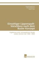 Einseitiger Lippenspalt-Verschluss nach dem Basler Konzept 3838130030 Book Cover