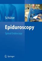 Epiduroscopy: Spinal Endoscopy 3540875441 Book Cover