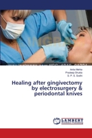 Healing after gingivectomy by electrosurgery & periodontal knives 3659552607 Book Cover