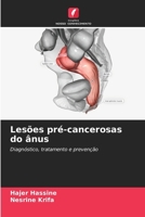 Lesões pré-cancerosas do ânus 6209116116 Book Cover