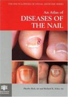 An Atlas of Diseases of the Nail (The Encyclopedia of Visual Medicine) 185070595X Book Cover