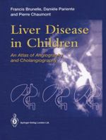 Liver Disease in Children: An Atlas of Angiography and Cholangiography 1447138244 Book Cover