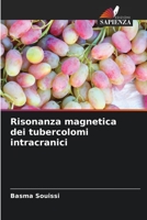 Risonanza magnetica dei tubercolomi intracranici 6206218406 Book Cover