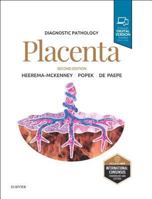 Diagnostic Pathology: Placenta 1937242226 Book Cover