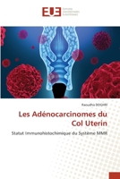 Les Adénocarcinomes du Col Uterin 6203438472 Book Cover