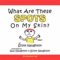 What Are These Spots On My Skin? 142590601X Book Cover