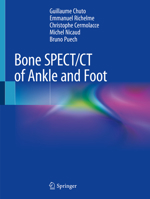 Bone SPECT/CT of Ankle and Foot 3319908103 Book Cover