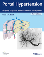 Portal Hypertension: Imaging, Diagnosis, and Endovascular Management 1626233276 Book Cover