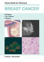 Breast Cancer: Visual Guide for Clinicians 1846920930 Book Cover