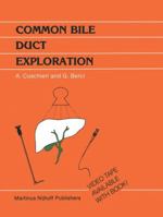 Common Bile Duct Exploration: Intraoperative Investigations in Biliary Tract Surgery (Developments in Surgery) 9400960050 Book Cover