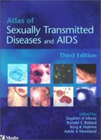 Atlas of Sexually Transmitted Diseases and AIDS 0702040606 Book Cover