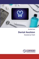 Dental Avulsion: Knocked out Teeth 6202523204 Book Cover