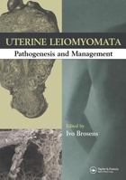 Uterine Leiomyomas: Pathogenesis and Management 1842143077 Book Cover