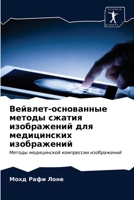 Вейвлет-основанные методы сжатия изображений для медицинских изображений: Методы медицинской компрессии изображений 6203597155 Book Cover