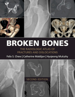 Broken Bones: The Radiologic Atlas of Fractures and Dislocations 1107499232 Book Cover
