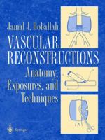 Vascular Reconstruction: Anatomy, Exposure and Techniques 1475774338 Book Cover