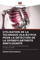 Utilisation de la Technique Hla-B27pcr Pour La Détection de la Spondylarthrite Ankylosante 6203239518 Book Cover